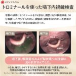 トロミナール 2kg